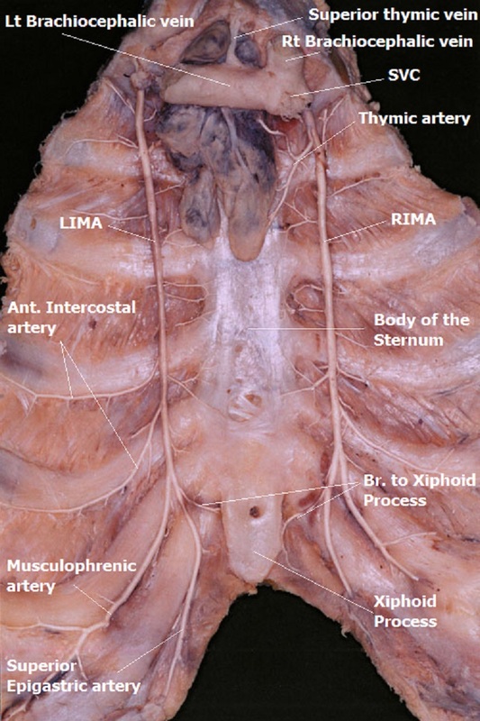 musculophrenic artery