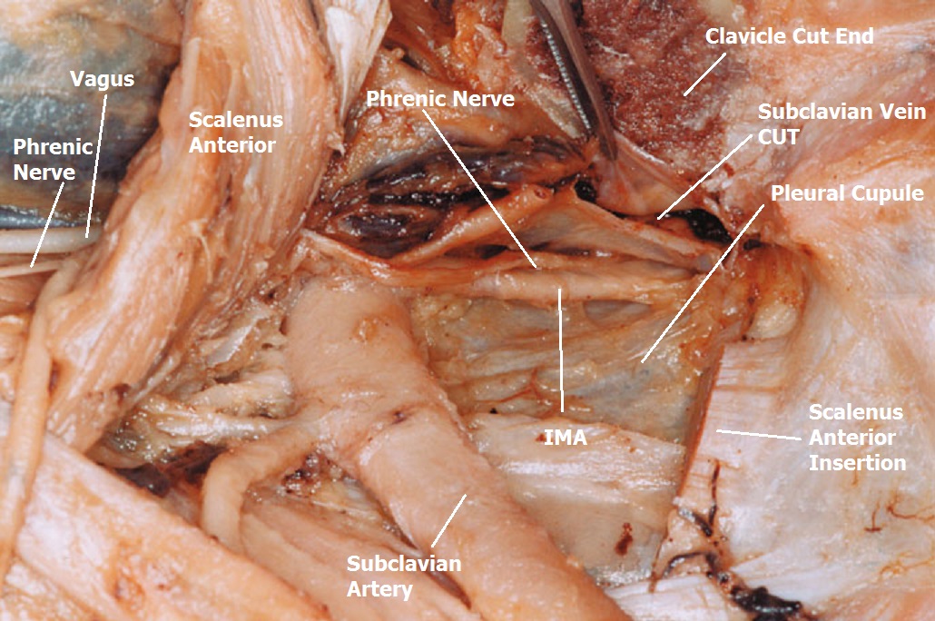 internal thoracic vein